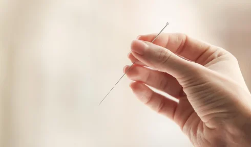 Acupuncture in Clifton, NJ: What Local Patients Should Know