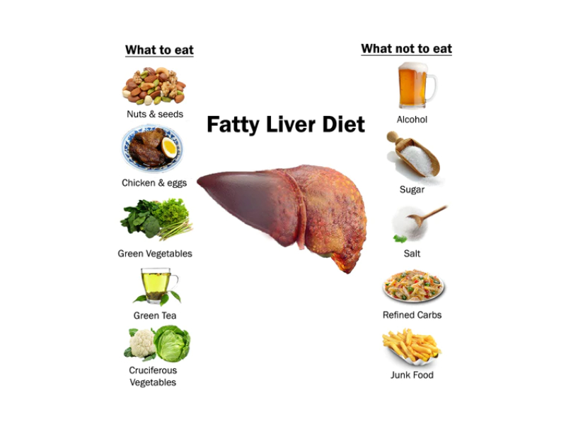 Fatty Liver Diet